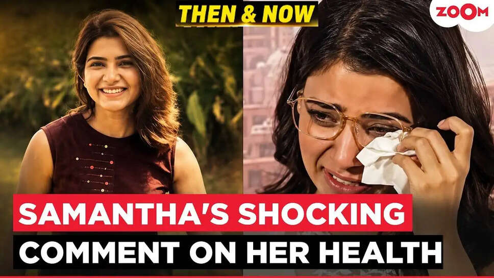 Samantha Ruth Prabhu की स्वास्थ्य यात्रा: Gelato नाम के पीछे की दिलचस्प कहानी