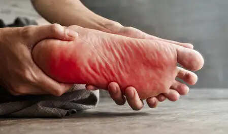 पैरों में जलन: क्या यह गंभीर स्वास्थ्य समस्या का संकेत है?