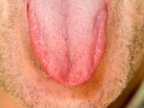 कई बार ऐसी खबरें आती हैं जो हमें हैरान कर देती हैं। ये खबर भी कुछ ऐसी ही है. फ्रांस में एक शख्स ने महिला से मारपीट की। उसके साथ दुष्कर्म करने की कोशिश की। फिर उस महिला ने जो किया उसे जानकर आप खुश हो जाएंगे और कहेंगे... वाह, क्या बहादुरी है.  घटना फ्रांस के एविग्नन शहर की है। डेली स्टार की रिपोर्ट के मुताबिक, एक महिला अपने कुत्ते को टहलाने के लिए घर से निकली थी. तभी किसी अज्ञात व्यक्ति ने उस पर हमला कर दिया। उसके कपड़े खींचने लगे। जबरदस्ती उसके गले लगकर चूमने लगा। महिला को समझते देर न लगी। उन्होंने बहुत संघर्ष किया। उसके साथ जमकर मारपीट हुई। लेकिन इसके बाद भी जब वह लगातार हमला करता रहा तो महिला ने किस के दौरान उसकी जीभ काट ली।  उसने मांस का एक टुकड़ा भी ले लिया महिला ने पुलिस से संपर्क किया तो मांस का टुकड़ा अपने साथ ले गई; इसे सबूत के तौर पर पुलिस को दिया गया था। यह देख पुलिसकर्मी भी सहम गए। उसके पूरे हाथ में खून लगा हुआ था। उसके हाथ में जीभ का टुकड़ा था। बाद में हमलावर को गिरफ्तार कर लिया गया। पता चला कि वह मूल रूप से ट्यूनीशिया का रहने वाला था और अवैध रूप से फ्रांस में रह रहा था। फ्रांस सरकार ने उन्हें फौरन देश छोड़ने का आदेश दिया है।  टेलर स्केबीज की कहानी दिमाग में आई सौभाग्य से महिलाएं टेलर स्केबीज की तरह क्रूर नहीं थीं। विस्कॉन्सिन की 24 वर्षीया टेलर स्कैबिज़नेस ने अपने 25 वर्षीय पति की हत्या कर दी और उसके शरीर के टुकड़े-टुकड़े कर दिए। उसने पति के प्राइवेट पार्ट को काटकर अलग कर दिया। उसका सिर भी काटकर बाल्टी में डाल दिया गया था। उसने टुकड़ों को कमरे के अलग-अलग कोनों में फेंक दिया। वह इस बात से नाराज थी कि उसके पति ने उसकी मर्जी के बिना उसके साथ शारीरिक संबंध बनाने की कोशिश की।हाल ही में महिला ने कोर्ट में अपने ही वकील पर हमला कर दिया।