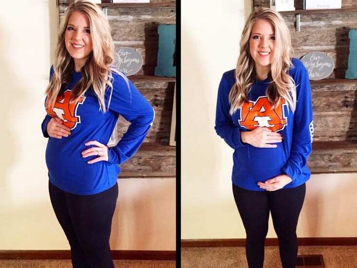 प्रेग्नेंसी समझकर खुश थी महिला, लेकिन सच जानकर रह गई हैरान, डॉक्टरों ने कहा- &lsquo;ये एक अनोखा मामला है&rsquo;